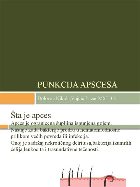 Punkcija – Vikipedija